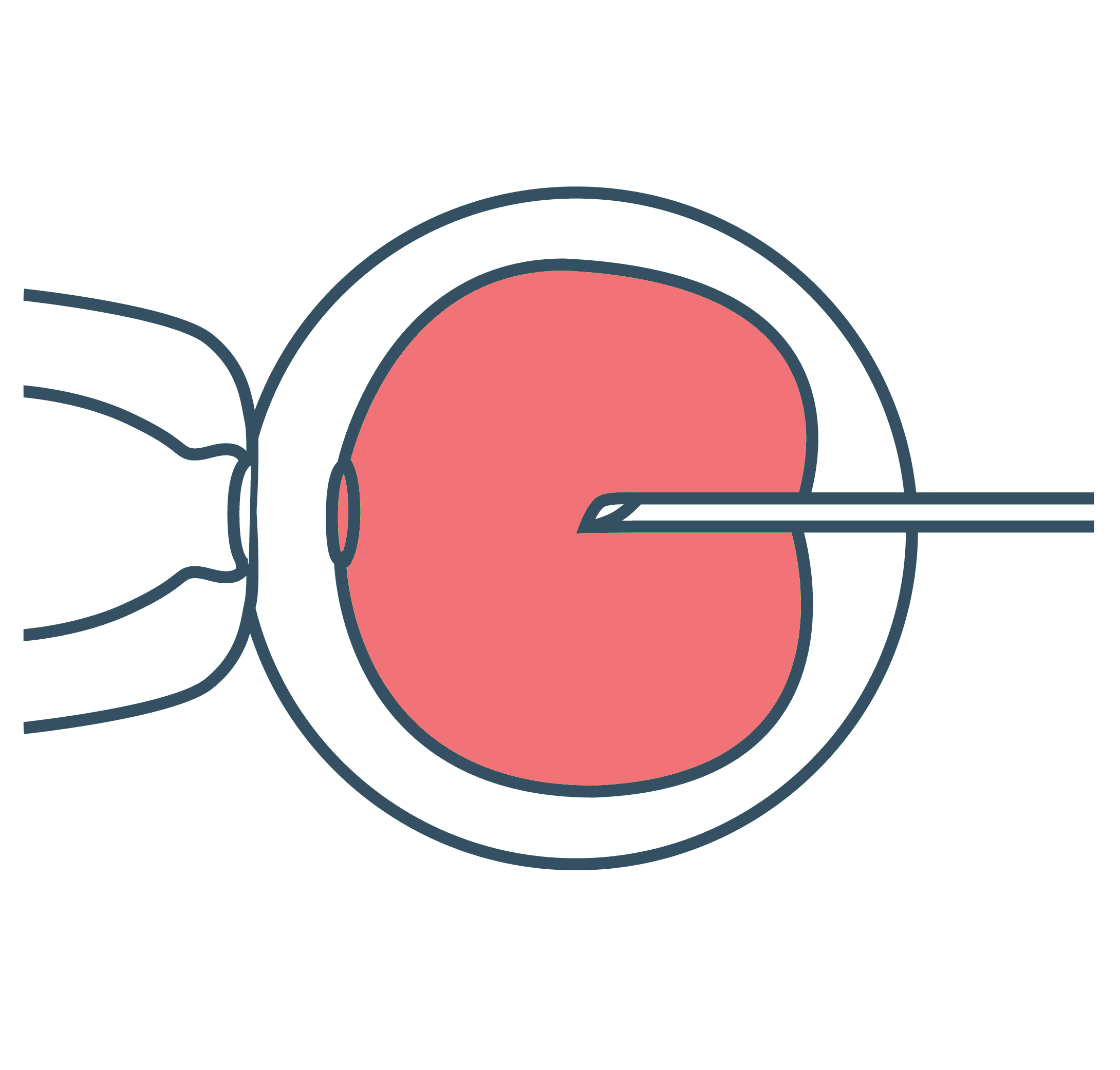 In Vitro Transcription