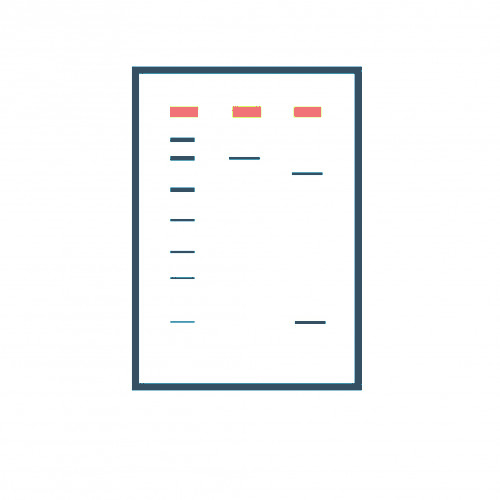 Gel Electrophoresis